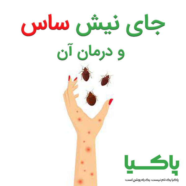 جای نیش ساس: درمان سریع و مؤثر گزش ساس تختخوابی